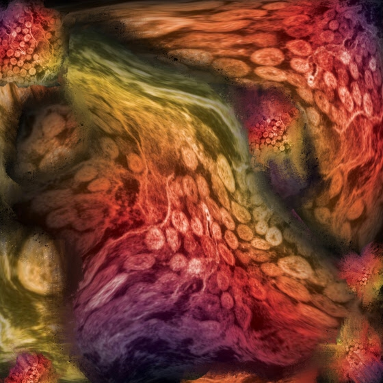 The Unwelcome Tenant